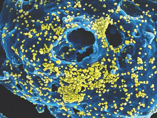 A zoomed-in image of a virus with blue swirls with yellow dots.